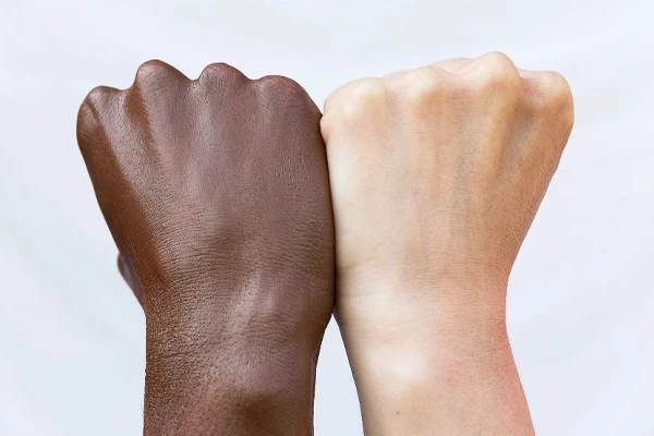 Two diverse hands side by side